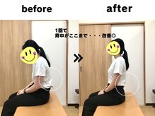 望ノゾミ整骨院の雰囲気（1回で実感！猫背・姿勢の変化をチェック♪）