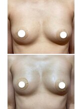 ルナグランデ(Luna grande.)/谷間部分がふっくら！！