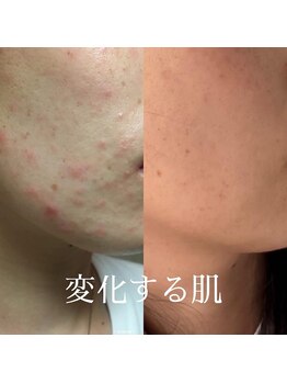 メイプルリーフ/お手入れ次第