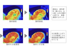 トウキ(TOUKI)/代謝向上体温アップ