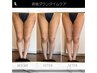 《インディバ術後ケア【体】抜糸後から◎》お体の浮腫み/凹凸緩和　【100分】