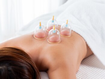 鍼灸ヨスガ(鍼灸Yosga)/カッピング