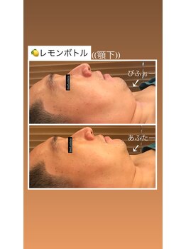 ノフ 恵比寿(noff)/レモンボトル