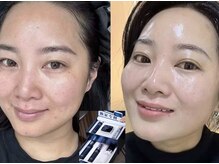 楽だの雰囲気（韓国水光肌☆ 肌のハリ・潤い・透明感アップ 敏感肌にも優しい）