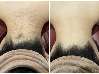 エステティック レイビス 八戸店(RAYVIS)/後ろ姿美人に♪