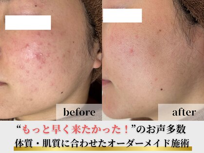 アエオボンヌール(A.E.O BONHEUR)の写真