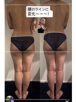 サロン ド エスポワール(salon de espoir)/インディバボディ Before/After