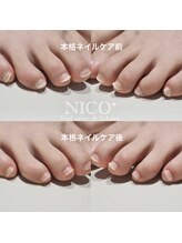 ニコプラス(NICO+)/足のお手入れできていますか？
