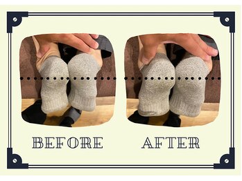 整体院プリュ/Before→ After［18］