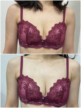 バーディー(BIRDIE)/施術１回/４０代ママ