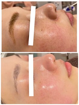 エステサロン ブレス 山形店(BLESS)/フェイシャル結果