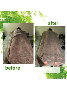 サロン ド リアン(Salon de lien)/ビフォーアフター/筋膜リリース