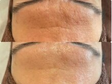 ラエッセ 目黒 白金台店(LAESSE)/毛穴・美白専門店 LAESSE 白金台