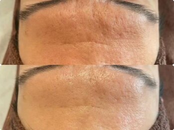 ラエッセ 目黒 白金台店(LAESSE)/毛穴・美白専門店 LAESSE 白金台