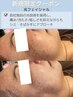 【シミ・くすみ改善】低刺激×即攻美肌◎次世代光フェイシャル¥16980→¥9980