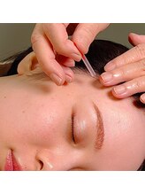 鍼灸 エル治療院/美容鍼