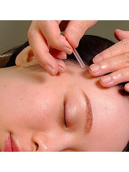 鍼灸 エル治療院/美容鍼