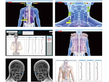 ユウシン 佐土原院(U-SHIN)/検査