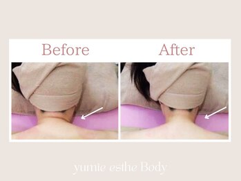 トータルビューティー ゆみえエステ(Total Beauty)/痩身/ボディ/筋膜リリースリンパ