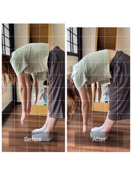 ミントのかべの整体院/ビフォーアフター