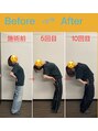 ハリヒト アランカール 仙台(HALicht Alankar) 猫背&骨盤矯正を続けると、ここまで改善されます!