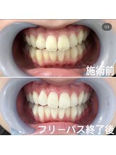 ルブラン 奈良店(Le Blanc)/清潔感アップ♪