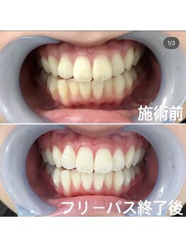 ルブラン 奈良店(Le Blanc)/清潔感アップ♪