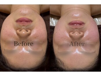 小顔 ツヤ肌/小顔+透明感 同時ケア