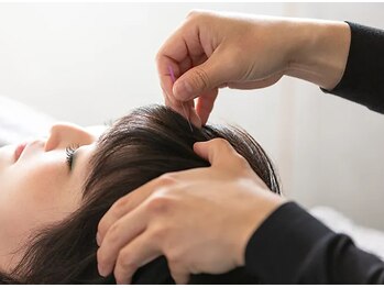 カーム 高松(Calm)の写真/＜休息で良くなるはずの不調が続く方＞頭の“自律神経のスイッチ”へピンポイントで整える希少な技術◎