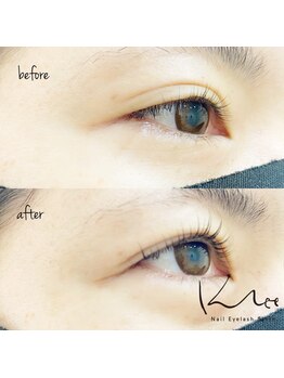 クレー(Klee)/パリジェンヌラッシュリフト