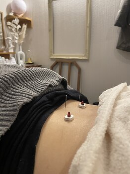 蒼月(aotsuki)/鍼灸施術