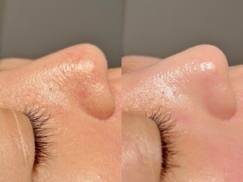 ルーナジェーナ(Luna llena)/池袋　エステ　ルーナジェーナ