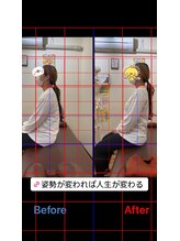 ヒデ整体院(Hide整体院)/猫背矯正骨盤矯正B/A肩こり腰痛