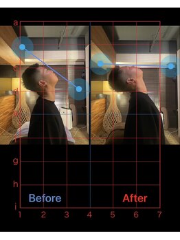 スリーピー 大阪本町/スマホ首剥がし四ツ橋本町心斎橋