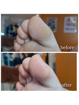 爪切り屋 足楽/