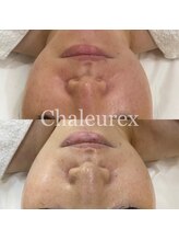 シャルル ストア 京都三条通(Chaleureux Store)/内側からも美しく