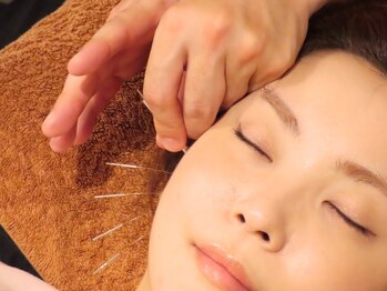 松尾整骨院の写真/【美容鍼でお顔のむくみやたるみ改善!】小顔・美肌・エイジングケアでお悩みの方は《松尾整骨院》にお任せ!