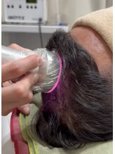 キヨラビューティー/頭皮ケア