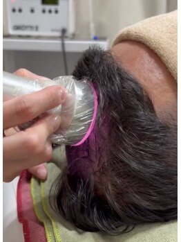 キヨラビューティー/頭皮ケア