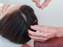 美容鍼灸salonまつもと