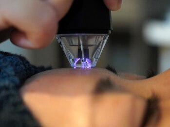 ジェミーサン(Gemmy Sun)の写真/【毛穴・たるみをリセット】極上プラズマ×本格ハーブピーリング★剥離なしで、隠さない自信の素肌へ!