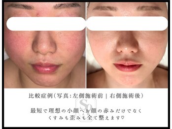 韓国肌管理室 ソア(soa)/【赤ら顔だけでなく歪みも矯正】