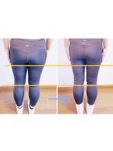 美尻のための矯正×ストレッチサロンPONO FIT.【ポノフィット】/症例／ヒップ