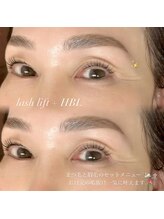 ノエル(Noel)/お目元のメンテナンス 担当なぎ