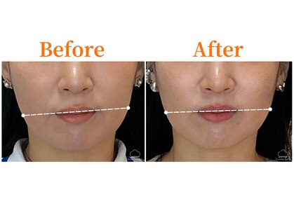 シルエラバレ(CiruelaValle)の写真