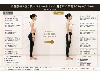 ミリョウ 整体院(MIRYO)の写真/ガチガチの首肩~骨盤、フェイスラインまで妥協なしの全身フル施術◎施術後のスッキリ感はやみつきに！