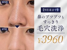 メンズテラス(MEN'S TERAS)の雰囲気(鼻のぶつぶつもすっきり★こちらのキャンペーン中♪3960円♪)