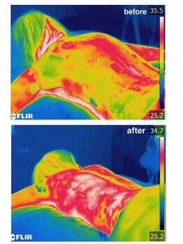 美人バスト 赤羽店/サーモグラフィでも科学的に証明