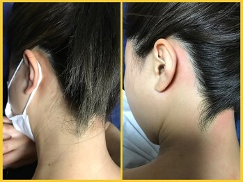 クラウン ジュエルズ(CROWN JEWELS)/【Wax脱毛】うなじ サイド 2