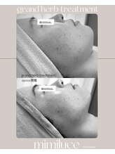 ミミルーチェ(mimiluce)/究極の肌質改善◎グランハーブ